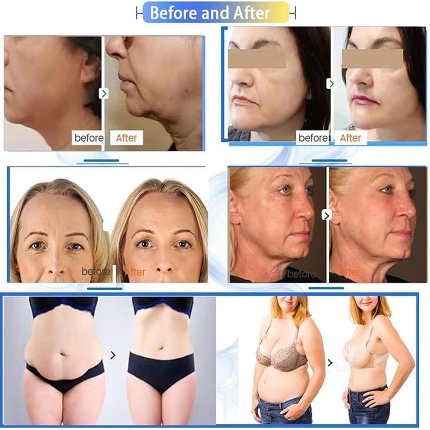 Urządzenie 7d Hifu Liftingu Twarzy I Modelowania Sylwetki, Profesjonalne Urządzenie Odmładzania Skóry Ciała I Pielęgnacji Przeciwstarzeniowej, 7 Wkładów, Urządzenie Pielęgnacji Twarzy