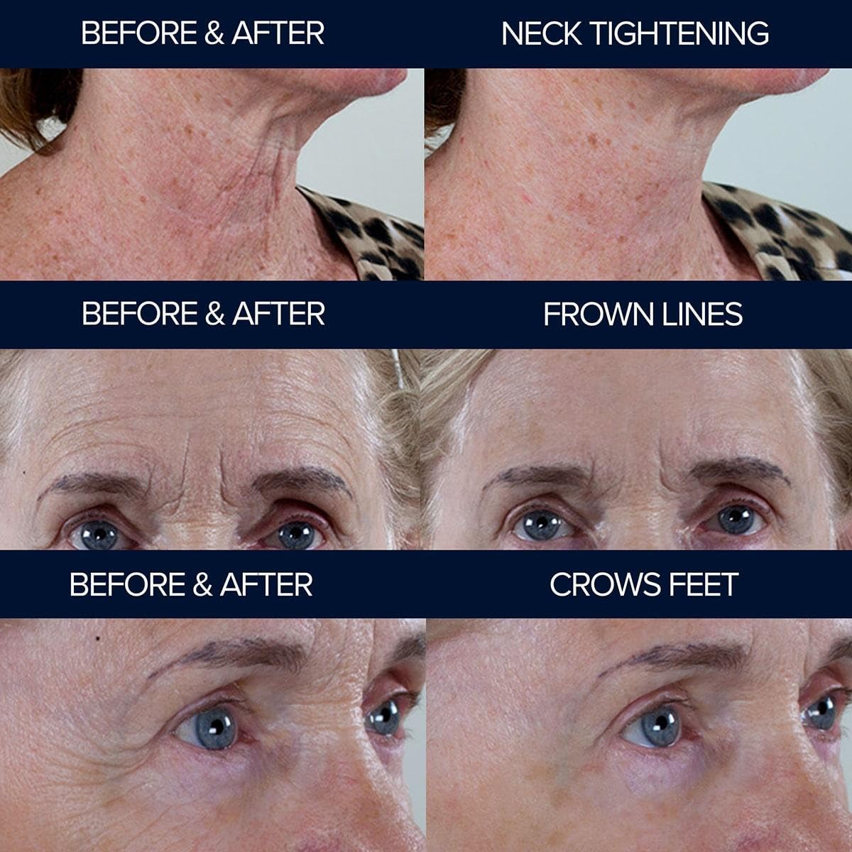Adonia Organics Peptide10 – Anti-Aging Peptide Serum – Firms, Smooths & Reduces Wrinkles – 2 Minutes