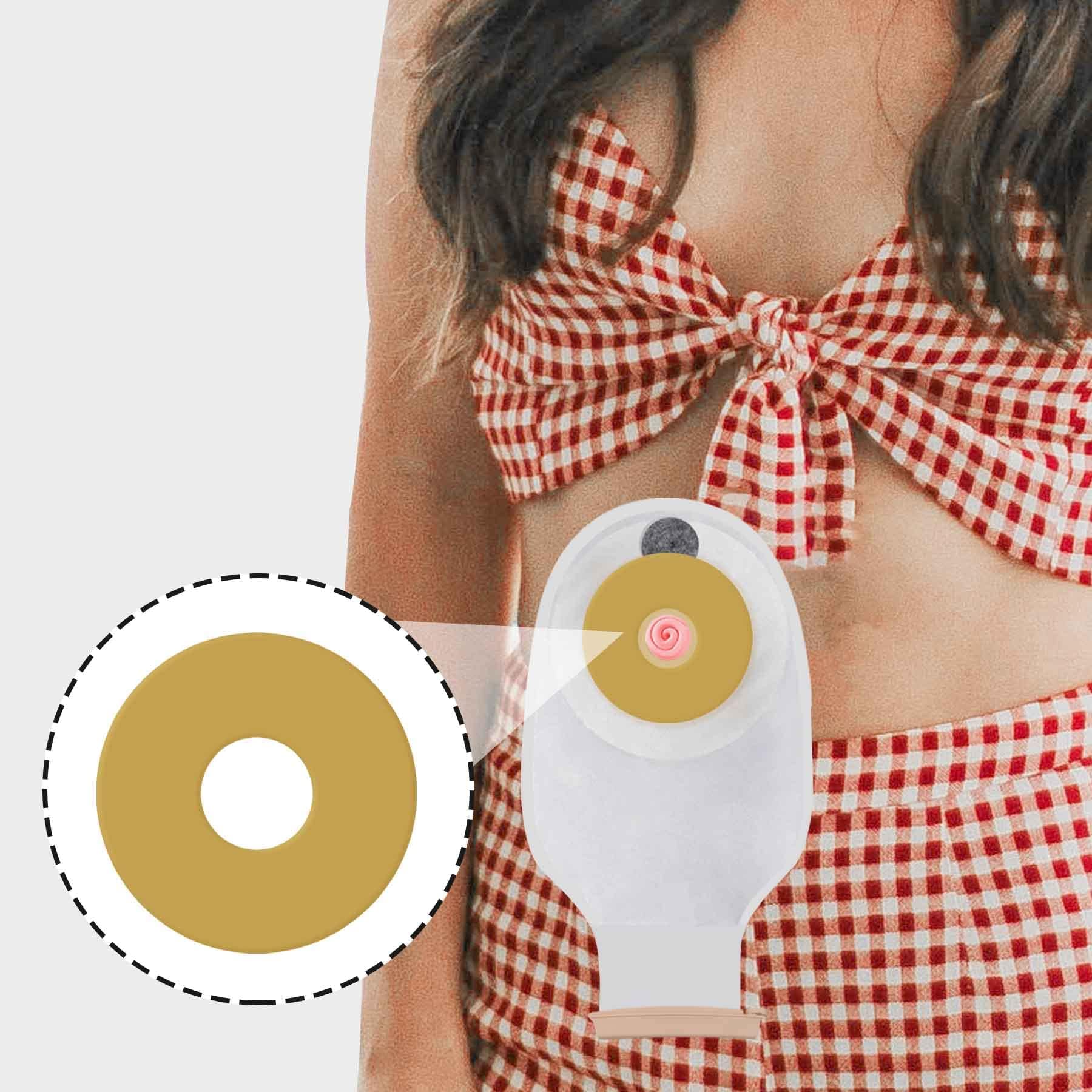 20 anillos de barrera de ostomía, anillos de ostomía moldeables, anillos extensores de piel hidrocoloides para bolsas de coloostomía, suministros de ostomía sin picaduras