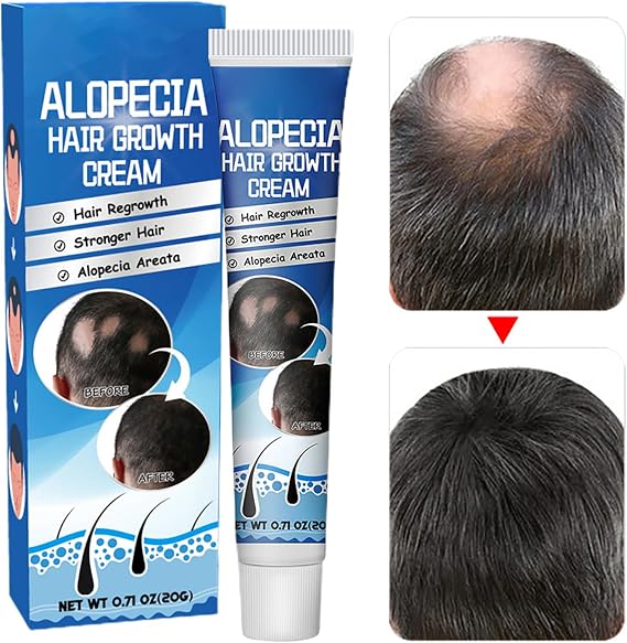 Hair Growth - Liquorice Regrowth Cream for Fast Hair Growth and Hairline Repair | 20g Anti Alopecia Oil with Nourishing Formula, Loss Prevention, Men Women Scalp Care
