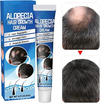 Hair Growth - Liquorice Regrowth Cream for Fast Hair Growth and Hairline Repair | 20g Anti Alopecia Oil with Nourishing Formula, Loss Prevention, Men Women Scalp Care