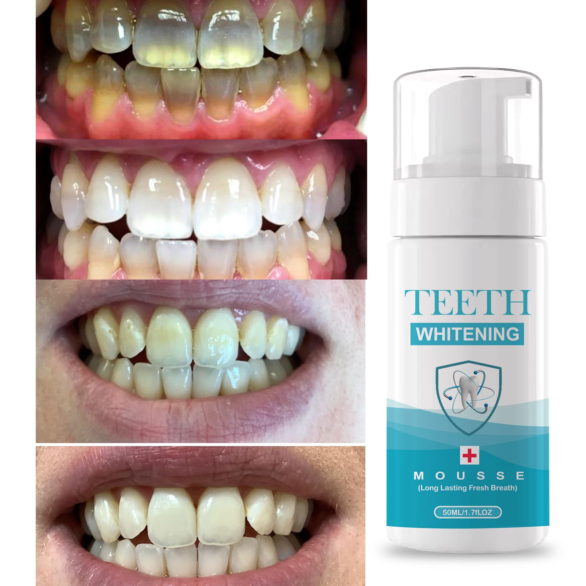Teeth Whitening Foam - 50ml Advanced Whitening Formula for a Brighter | for Men & Women | 50ml (B0D1QKFXHW) Amazon Price History, Amazon Price Tracker
