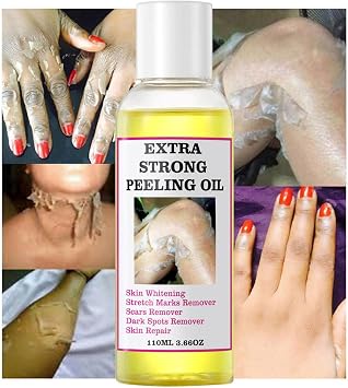 Peeling Oil, Lightening Exfoliat-ing Dark Skin For Body, Skin Peeling Oil For Skin Lightening, Ffective Gentle Body Exfoliate Extra Strength Whitening, Peeling Solution Dark Skin, 110ml