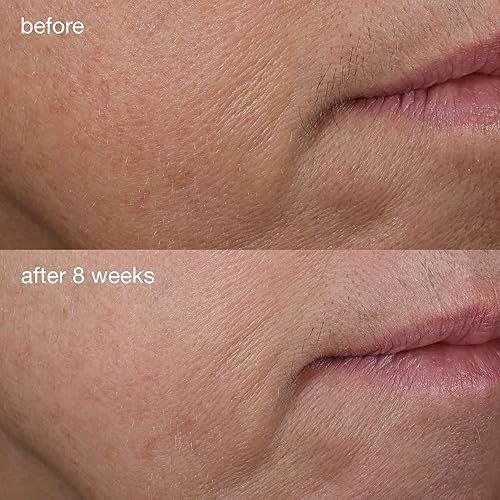 Miniatura 3 de Dermalogica Phyto-Nature - Suero reafirmante antienvejecimiento con ácido hialurónico, revitaliza, levanta y reafirma la piel para reducir las