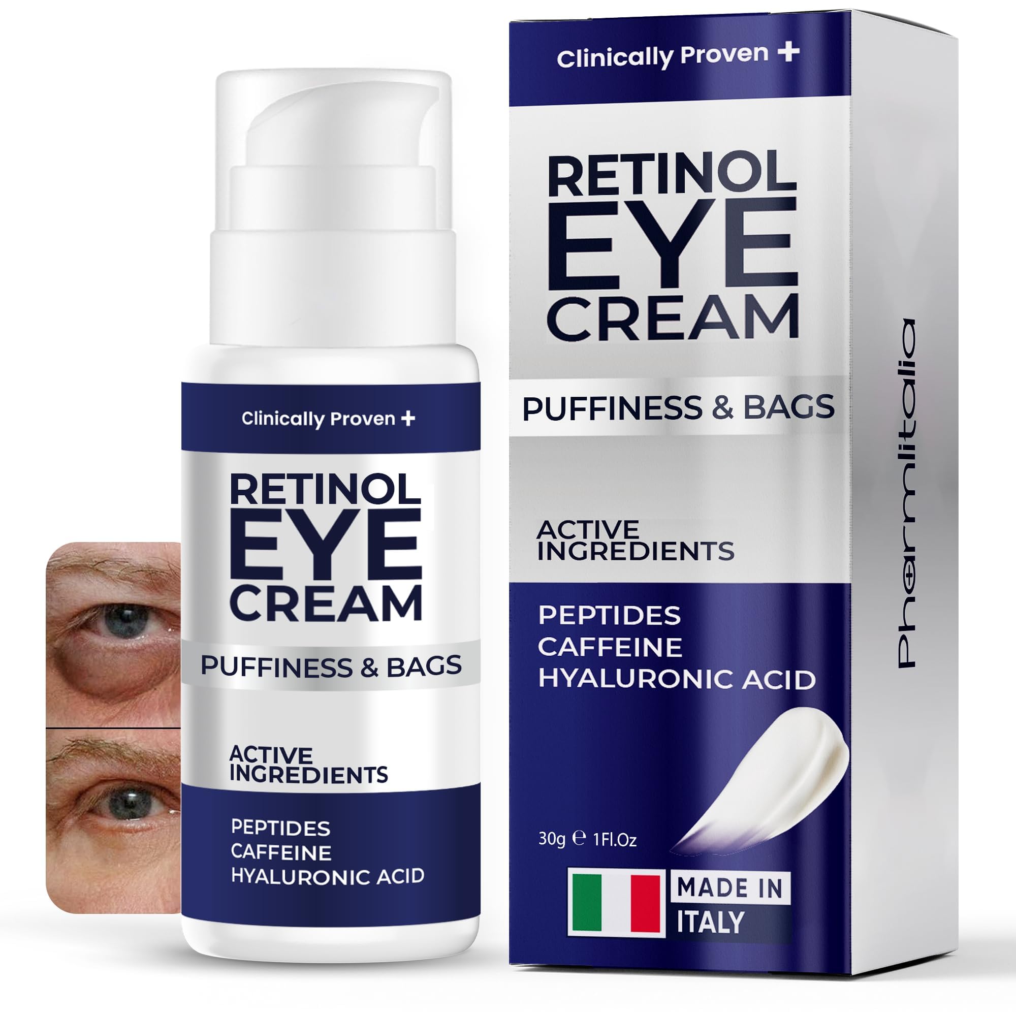 Under Eye Cream for Puffiness and Bags Under Eyes, Eye Bags Treatment for Men & Women - Anti Wrinkle Cream for Dark Circles, Baggy Eyes Treatment for Women with Retinol, Hyaluronic Acid & Caffeine