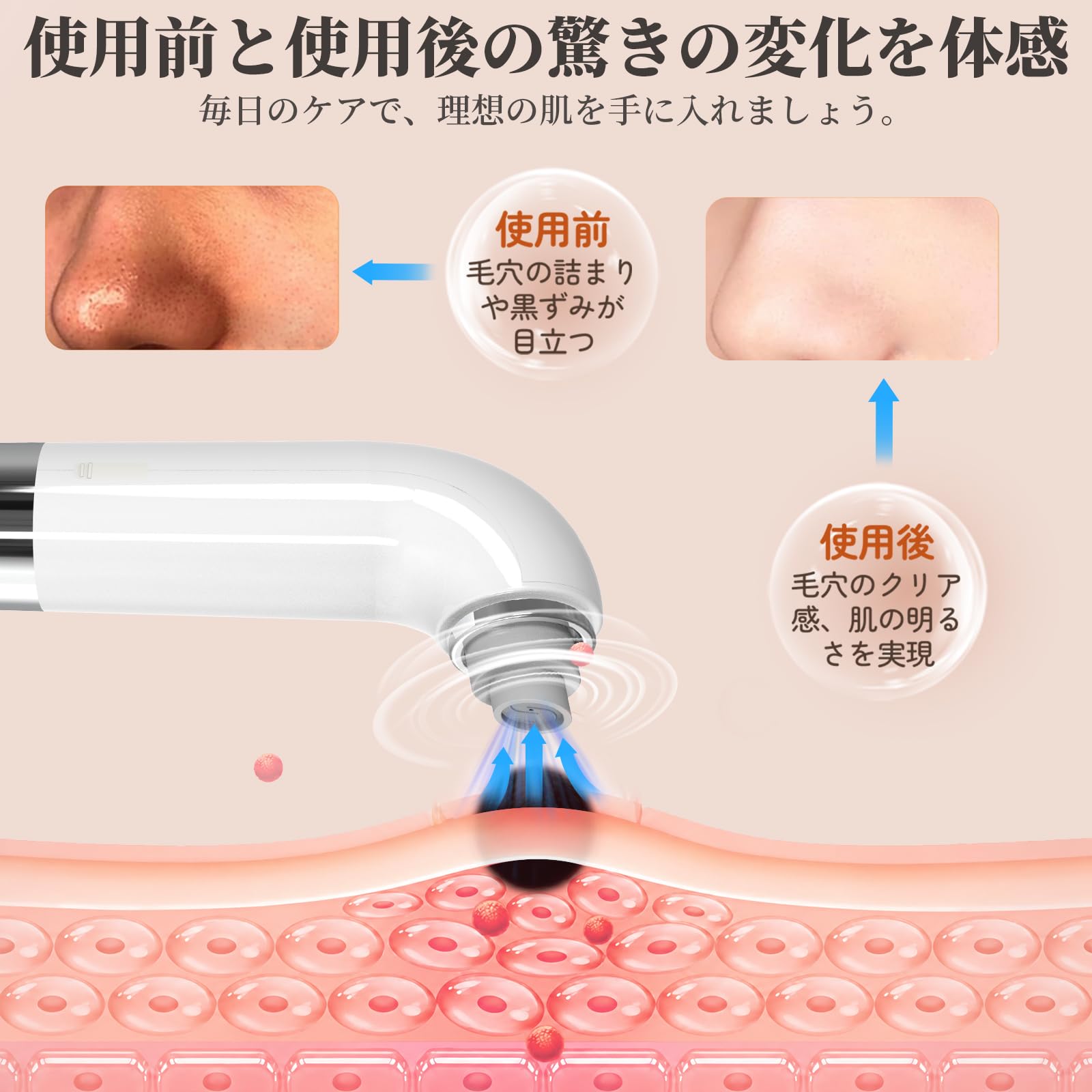 Amazon.co.jp: 毛穴吸引器 水流式 美顔器 【水槽分離毛穴洗浄型】 美容