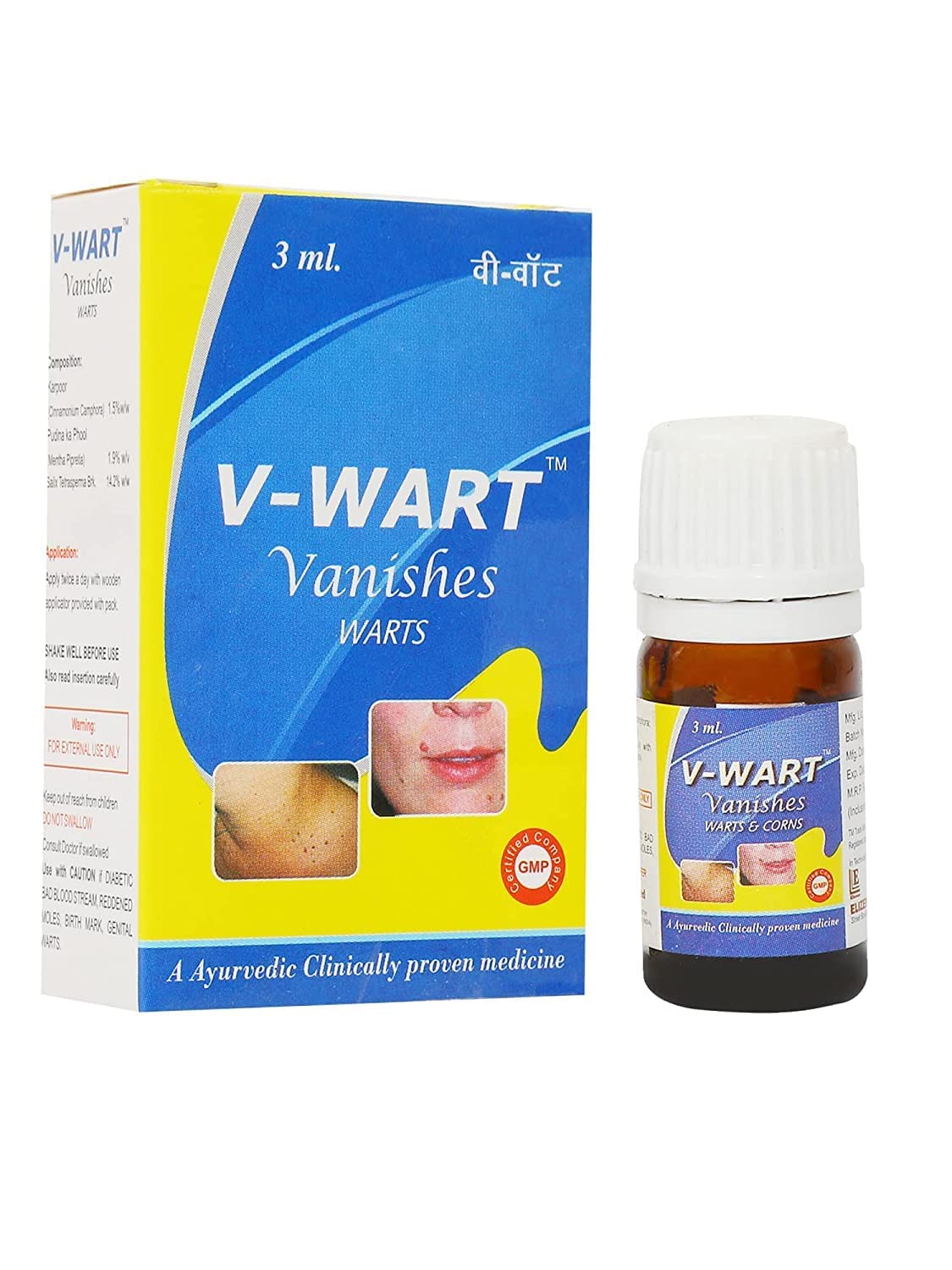 V-Wart Remover Liquid Rapidly Eliminates Both Plantar and Common Warts | Effective Painless Wart Removal Treatment with Wooden Applicator | Advanced Natural Formula - Pack Of 1 (3ML) Wart remover ointment, Wart remover cream for wart removal | massa remover ointment for skin (Multicolour)