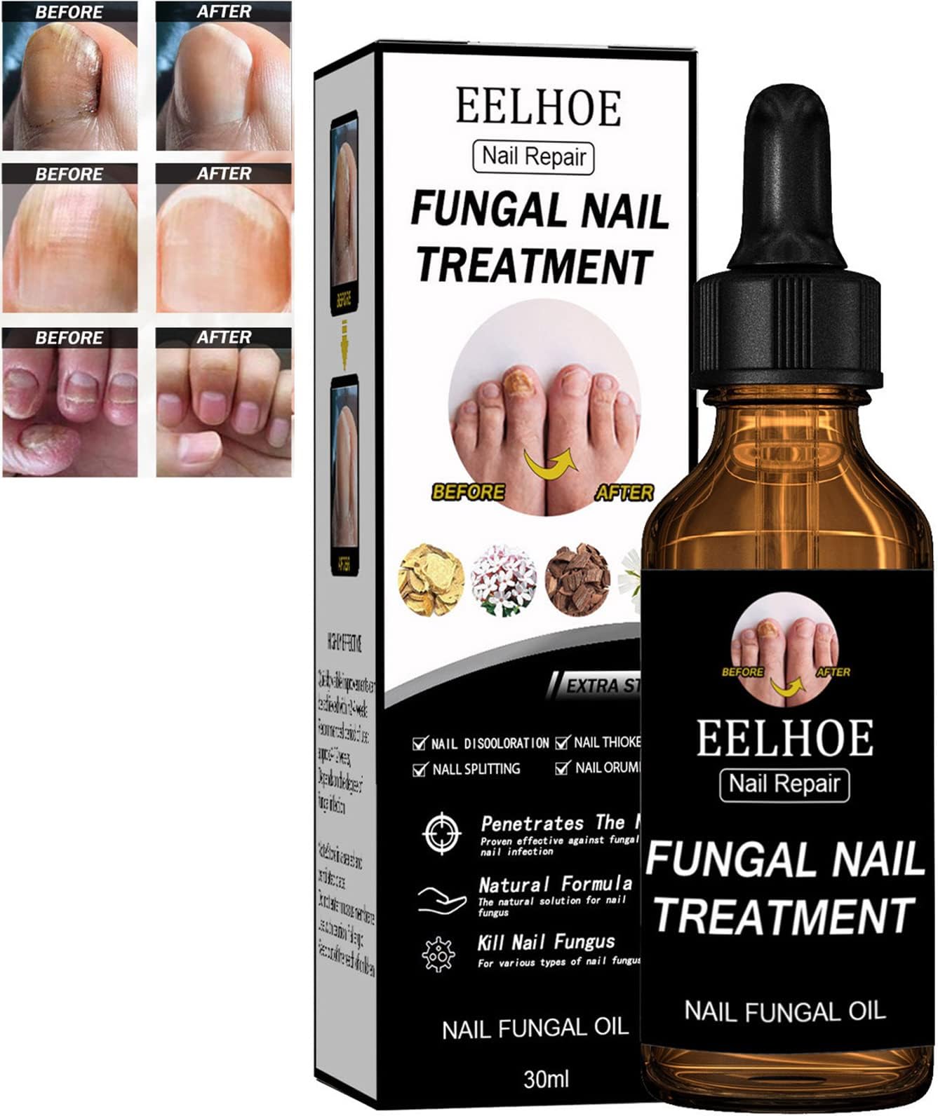 VUCATIN Toenail fungus treatment, Extra Strength Toe Nail Fungus Treatment for Toenail Or Fingernail, Toenail Fungus Kille Nail Repair Solution Restoring Healthy Nails Renewal Liquid