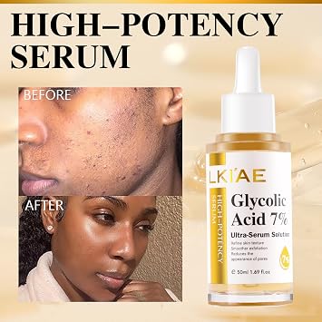 LKIAE Glycolic Acid 7% Ultra-Serum-Solution, Brightening, Moisturizing, Reduce Dark Spots, Refne Skin Texture For All Skin Types, With Glutathione, Vitamin C, 1.69 fl oz (Pack of 1)