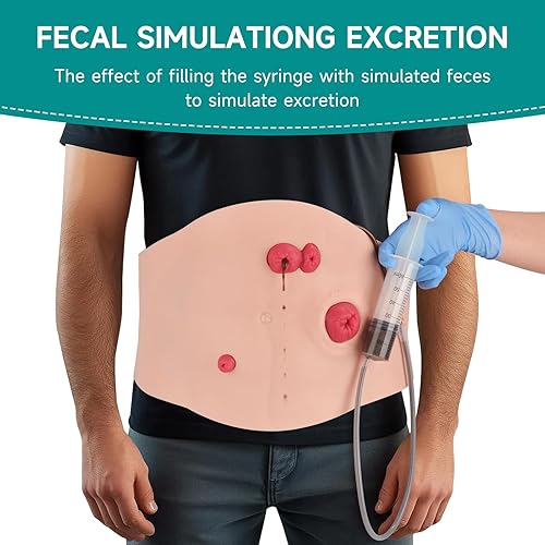 Miniatura 3 de Kit de entrenamiento para el cuidado de la ostomía del vientre, modelos de estoma para educación médica, kit de modelo de práctica de ostomía para