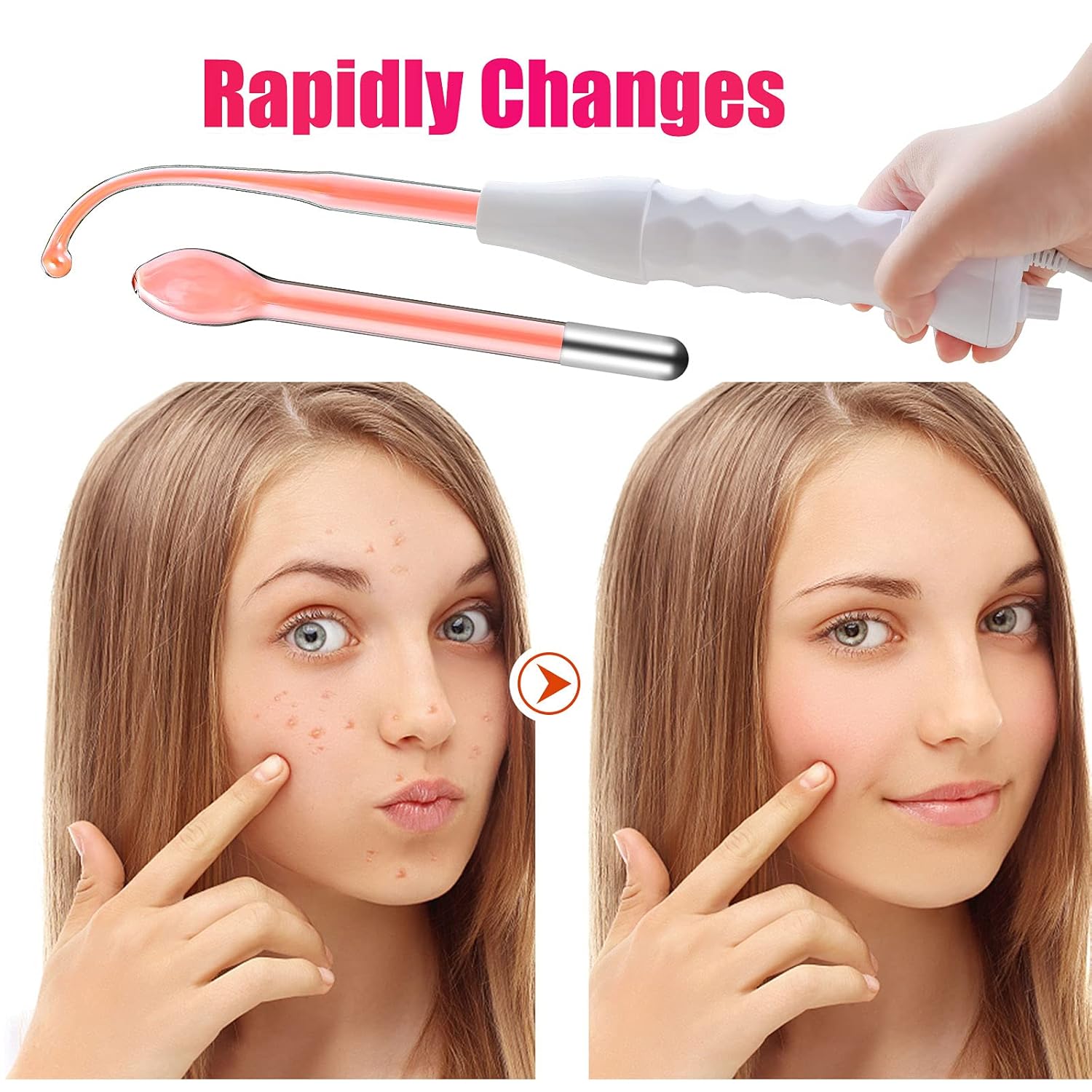 High Frequency Machine, SFENNGPET Portable High Frequency Facial Machine for Eyes Body Care Spa Salon Home : Beauty & Personal Care