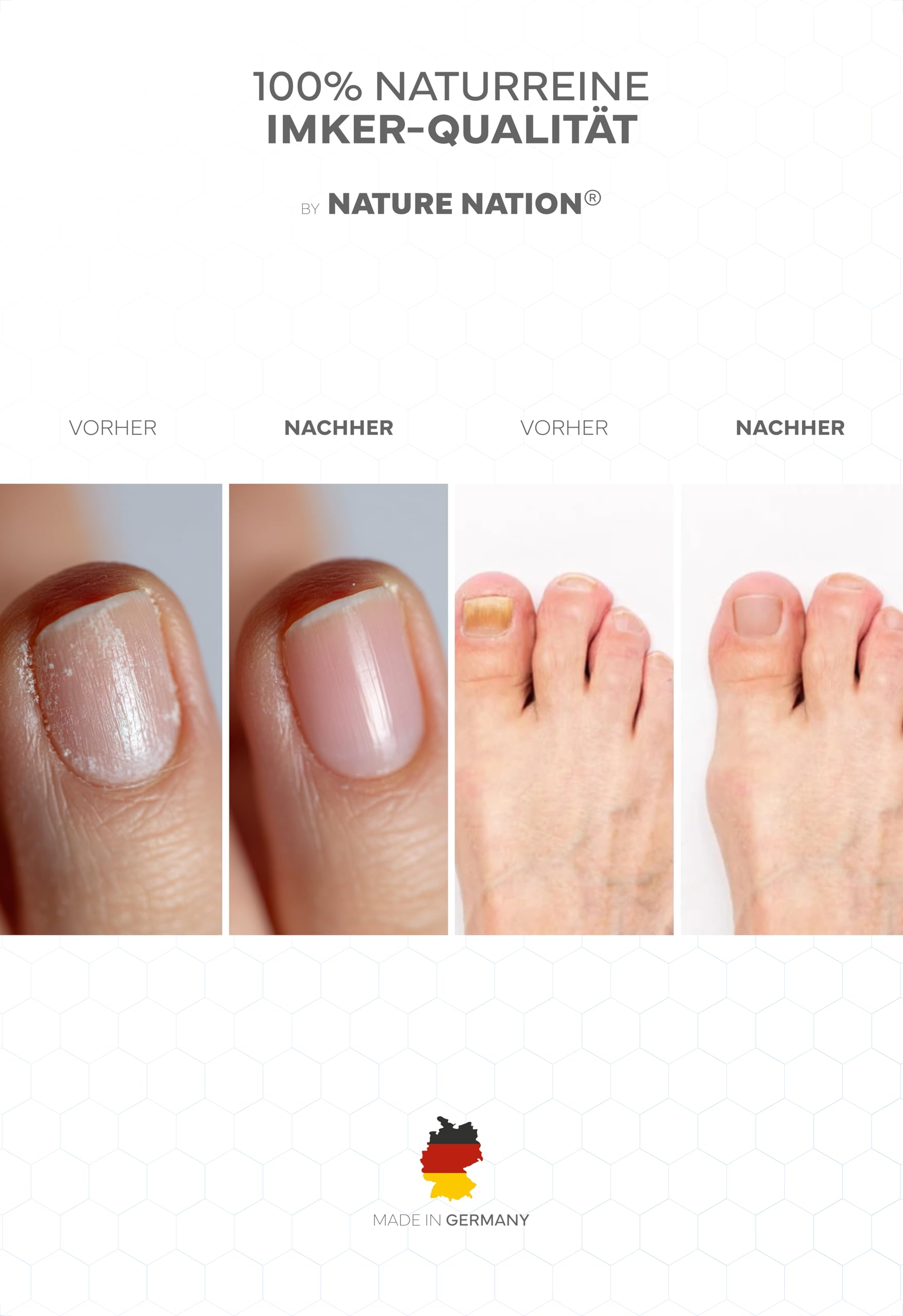 BIO Propolis Nagelserum: Akute Intensivpflege bei Nagelpilz; Mit hochdosiertem Propolis (40%), Teebaumöl & Lavendel sowie Vitaminen & Mineralien (Zink, Selen & Biotin); Für gepflegte & starke Nägel