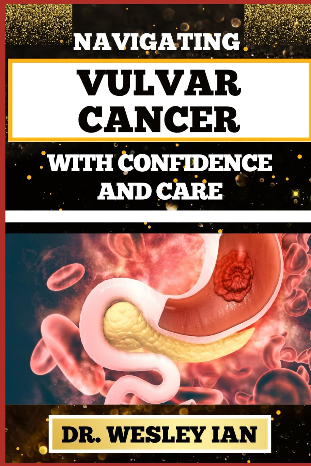 NAVIGATING VULVAR CANCER WITH CONFIDENCE AND CARE: Empowering Insights And Strategies For Confronting Cancer Health Challenges For Female Genitals Recovery