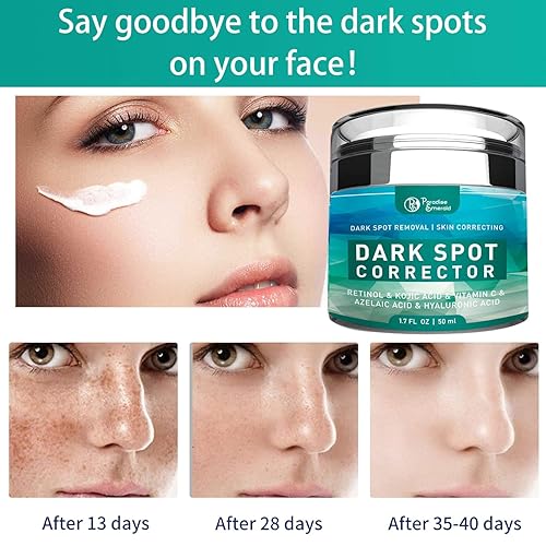 Miniatura 2 de Eliminador de manchas oscuras para cara, tratamiento de hiperpigmentación, melasma, pecas, eliminación de manchas solares para todo tipo de piel,