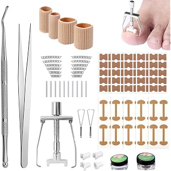 Ingrown Toenails Set Nail Clip Toenail Correction Ingrown Toenail Correction Toenail Correction Patch for Toenail Ingrown