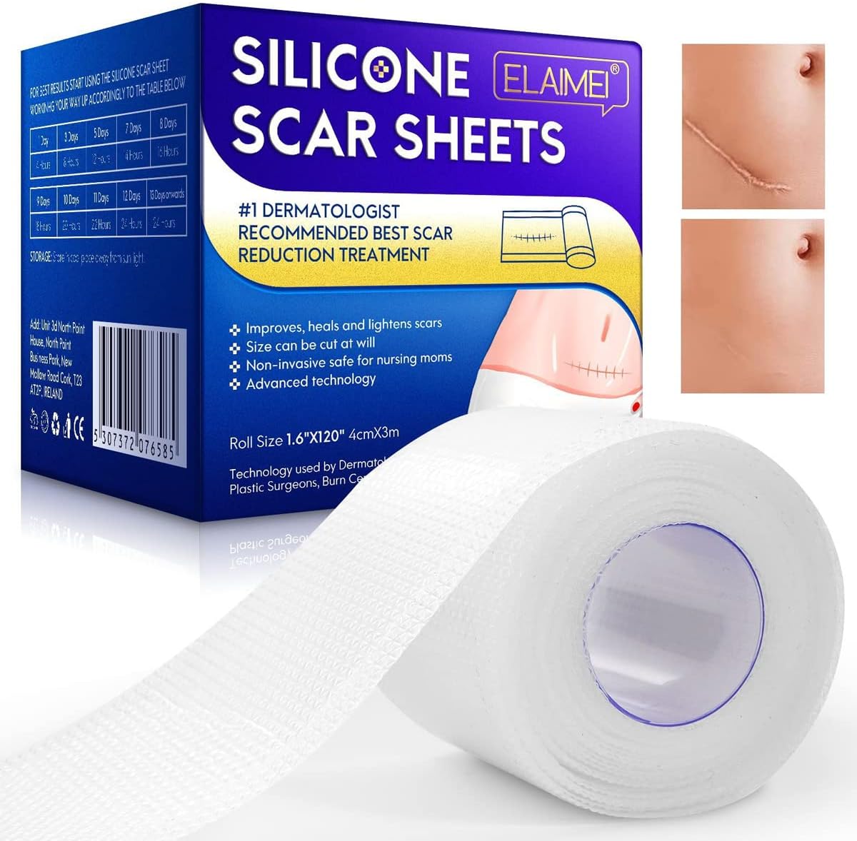 HANNEA® Silicone Scar Sheets, Silicon gel sheets for Scars Transparent Medical Silicone Gel Tape for Scar Removal, Silicone Scar Tape Roll For Hypertrophic Scars and Keloids Caused by Surgery