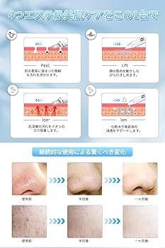 リフチューンandウォーターピーリング Amazon.co.jp: ウォーターピーリング 美顔器 超音波振動 【2.4万