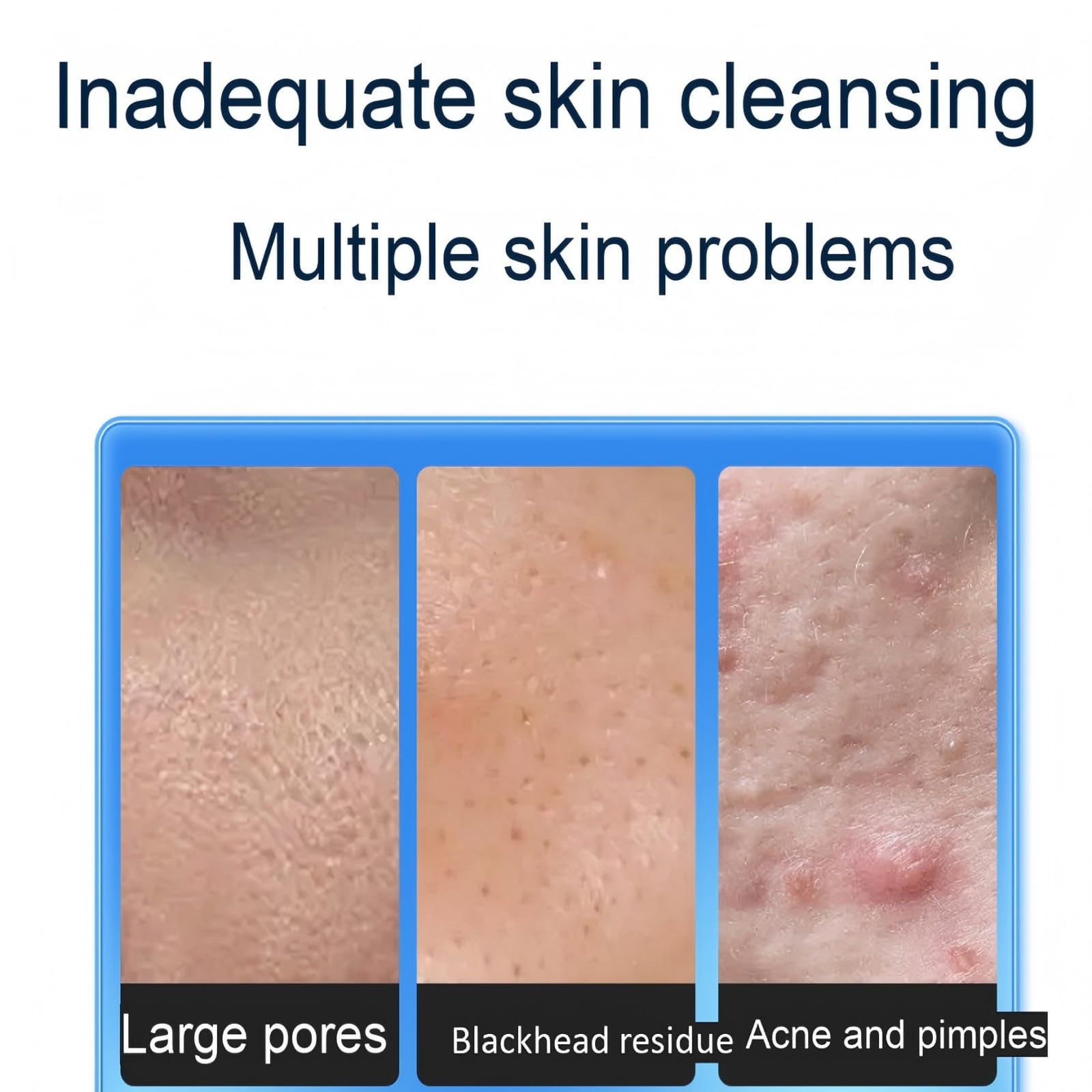 Aspiratore Punti Neri Professionale Ricaricabile, Rimozione Punti Neri e Pulizia Viso Profonda con 6 Testine e 4 Modalità, Aspira Punti Neri Elettrico per Donna e Uomo, Bianco