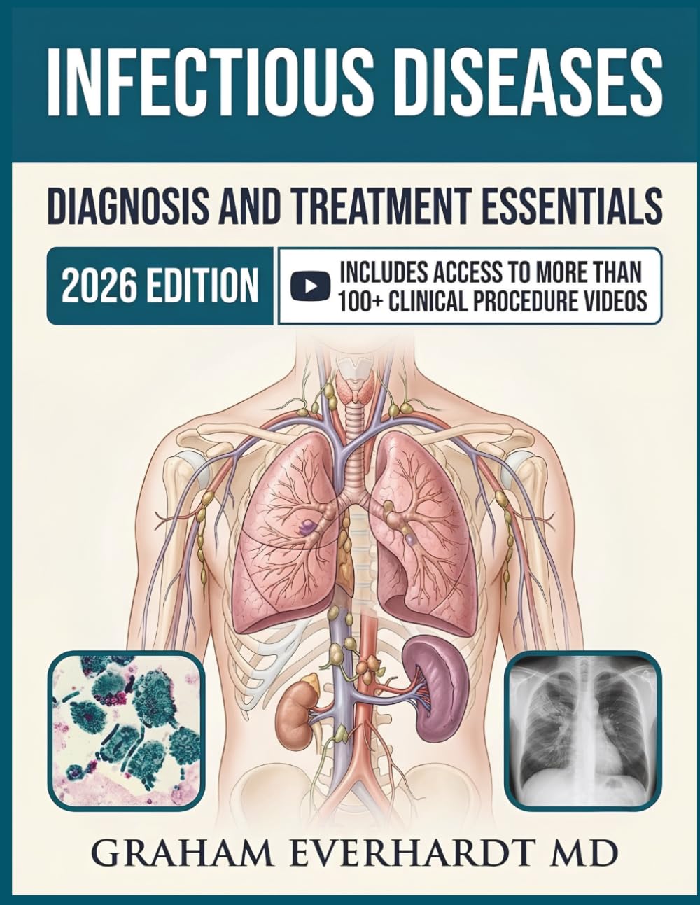 Infectious Diseases Diagnosis and Treatment Essentials: A Clinical Guide to Antimicrobial Therapy, Stewardship, and Evidenced-Based Management