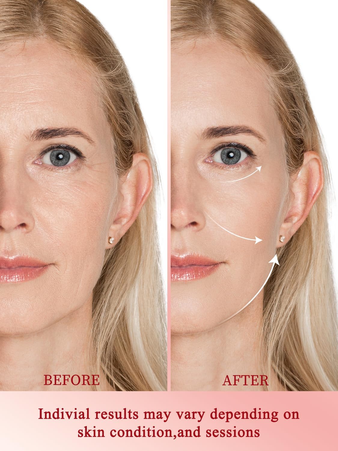 Radio Frequency Skin Tightening Device, Professional Wireless Home RF Skin Tightening Face Machine, 3 Levels for Smooth Fine Lines, Lifting, Firming