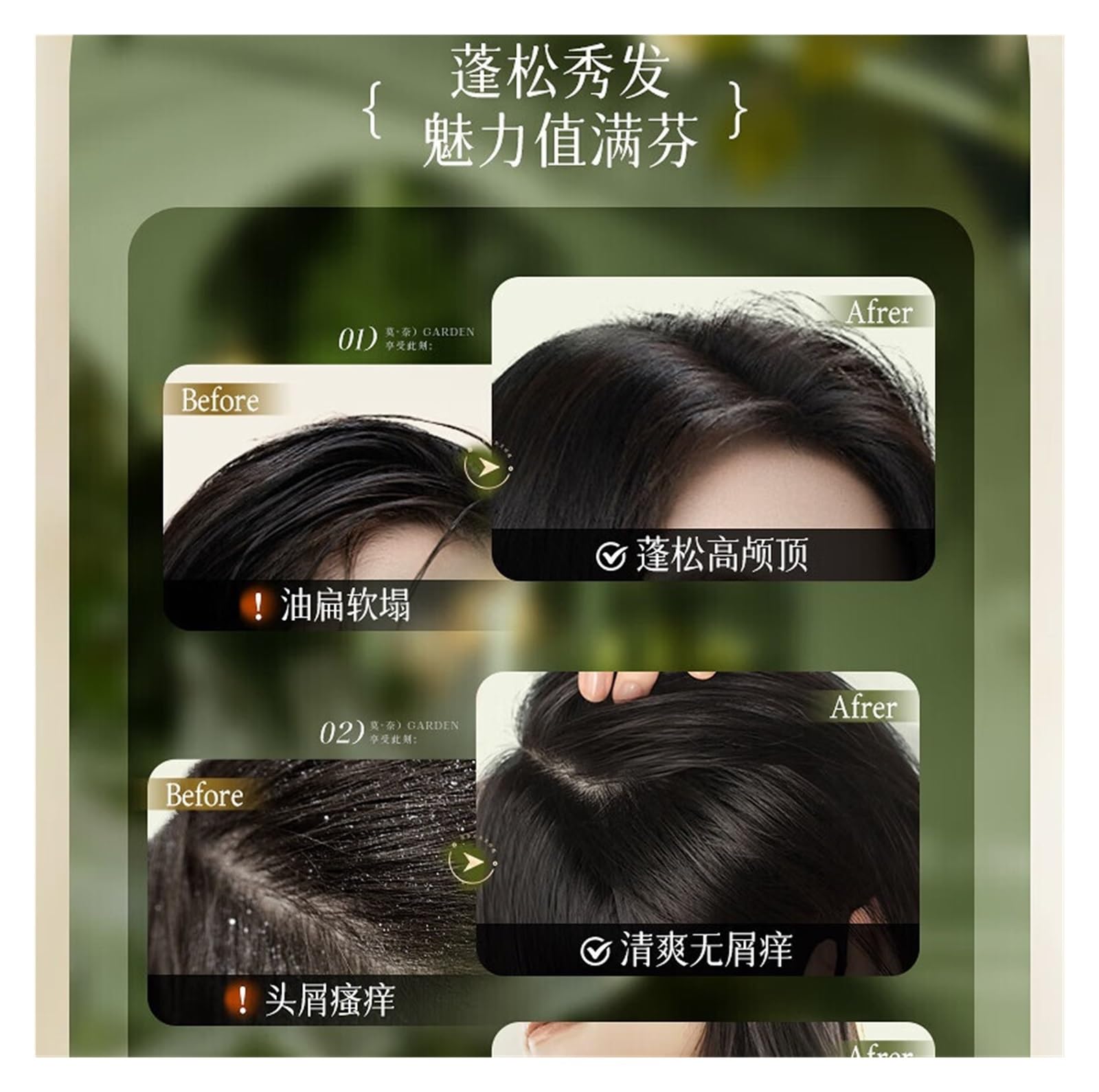 Champú anticaspa y control de grasa | Control eficaz de la caspa y gestión de la grasa, lo que da como resultado una piel naturalmente voluminosa.(3pcs)