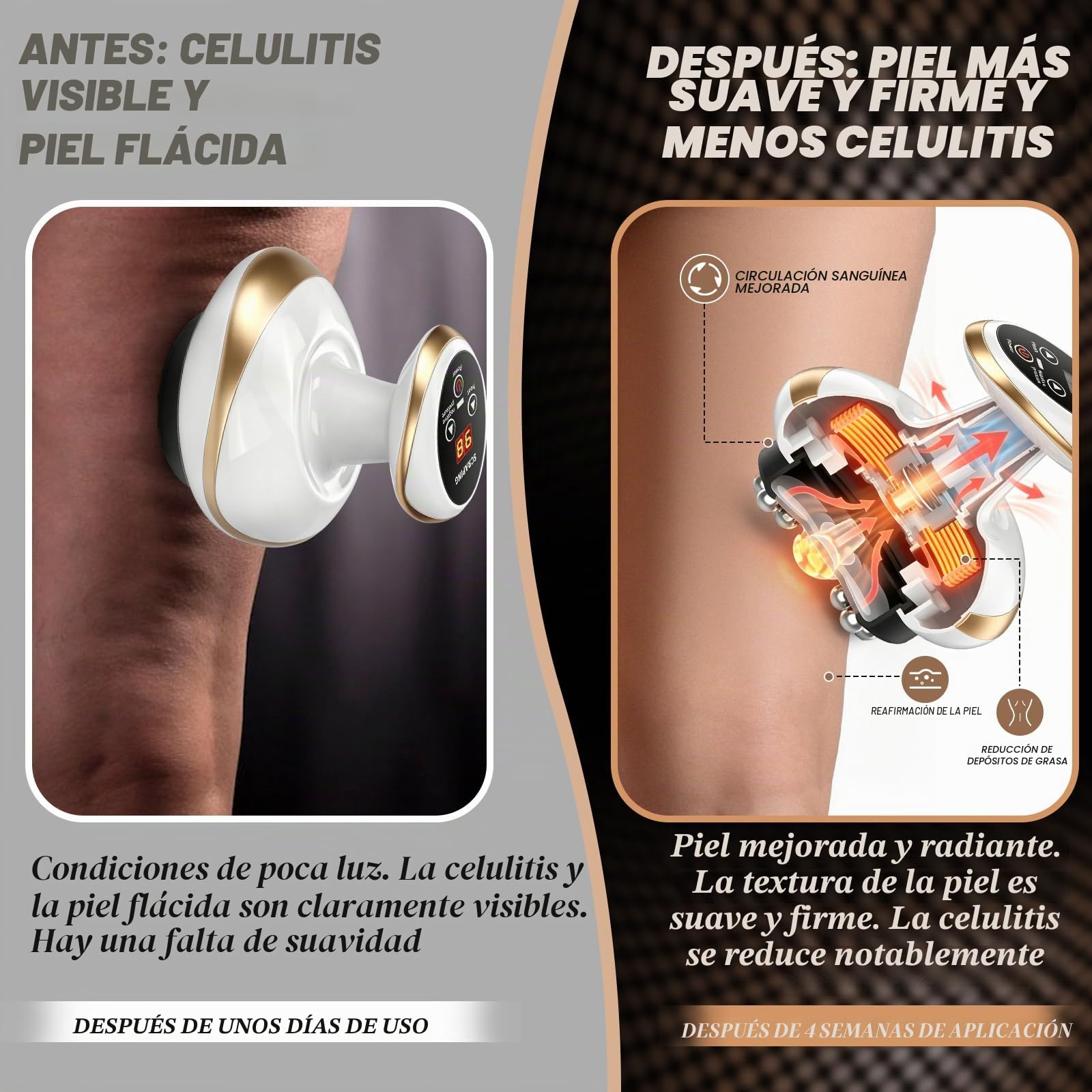 Maquina Celulitis 4 en 1, Masajeador Anticelulítico con Luz Roja y Calor, 9 Modos Vacum Vacuvia, Portátil y Recargable, Masajeador eléctrico GuaSha para Celulitis en Abdomen, Cintura y Brazos