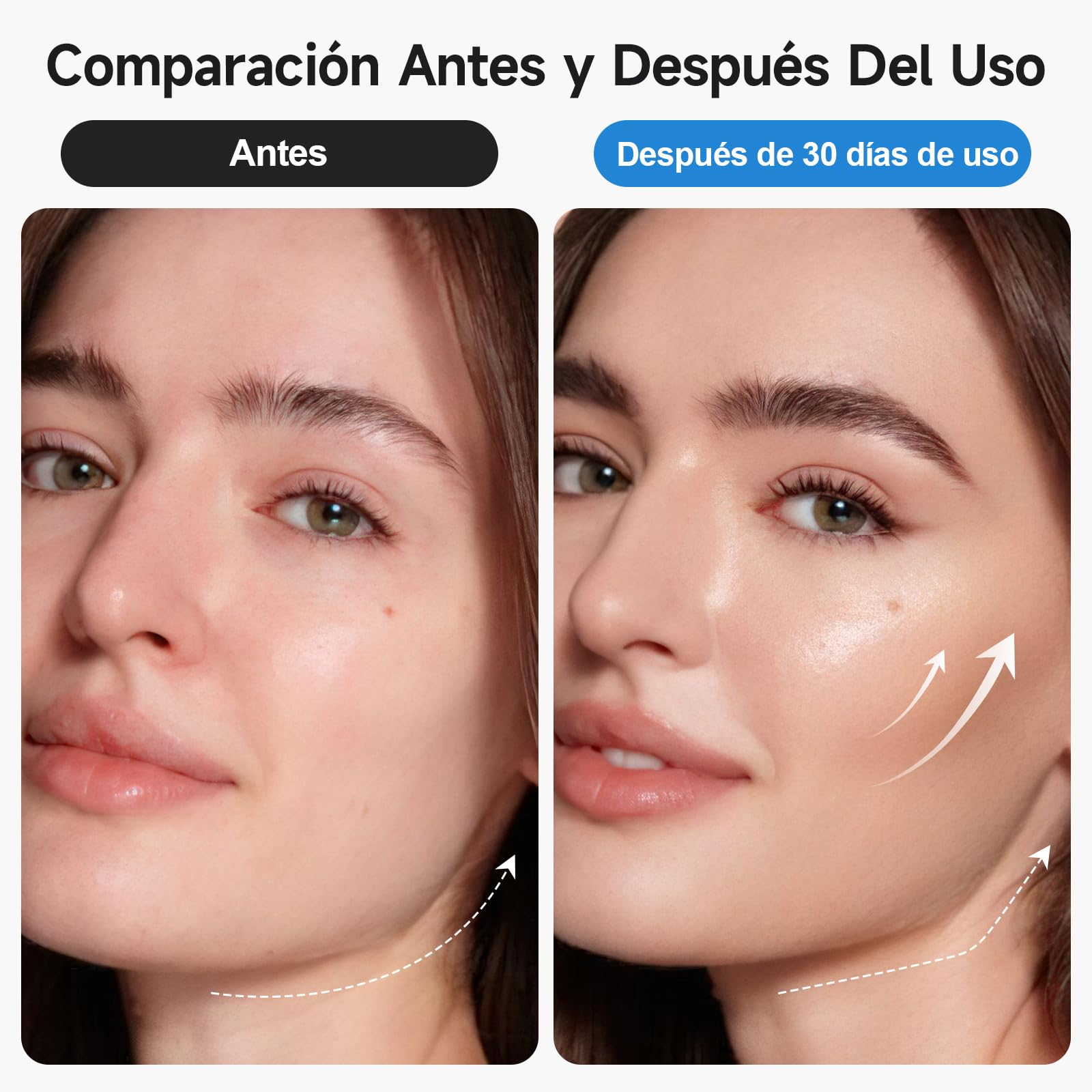 Ventosas 3 en 1 anticelulítico | Ventosas, EMS, luz roja. Abdomen/piernas/glúteos, 3–5 min/día, piel firme
