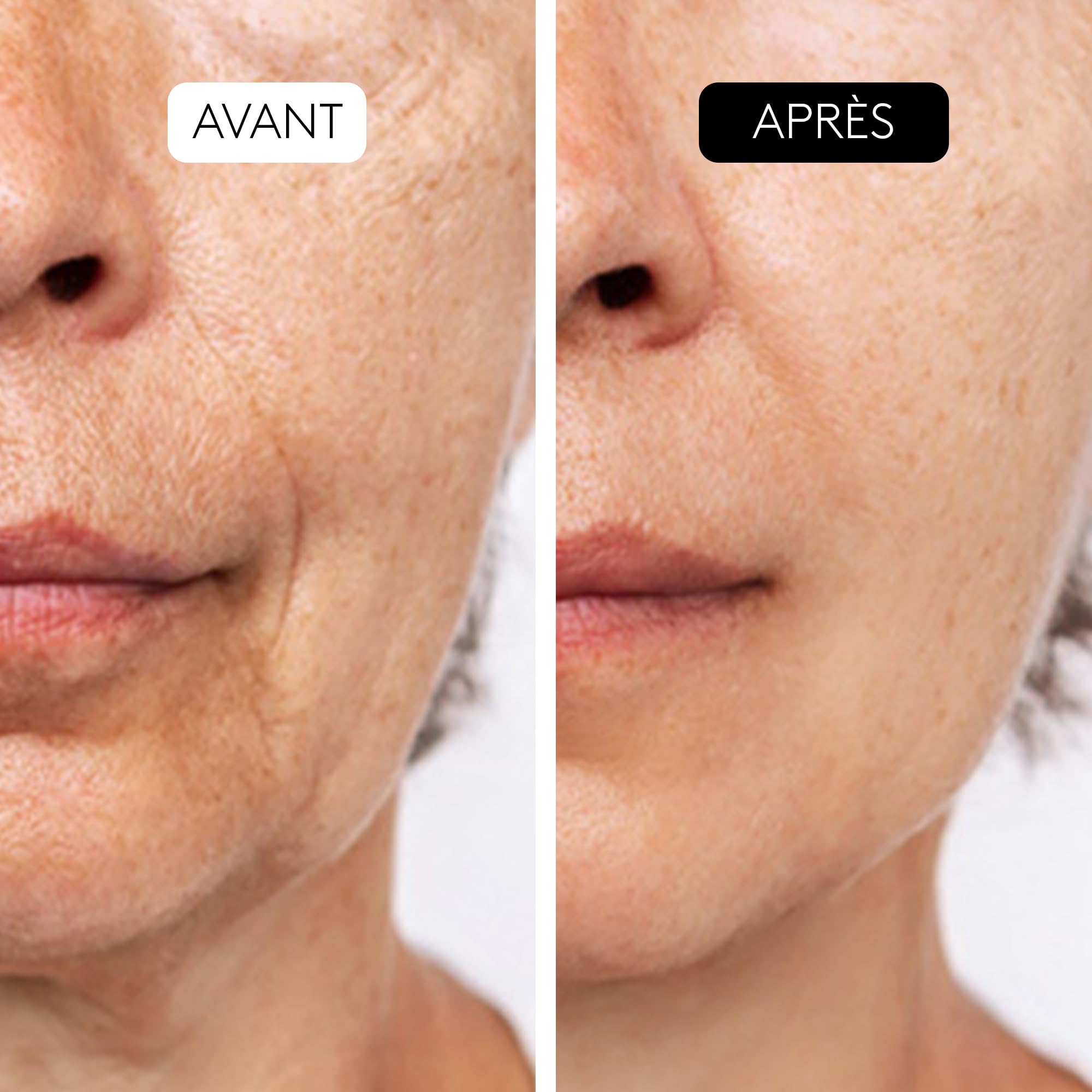 COCUNAT Triple Sérum Exfoliant AHA COMPLEX 10% Peeling Anti-Âge 30ml | Peeling visage quotidien aux acides glycolique, mandélique et lactique. Renouvelle la peau, réduit rides et taches.