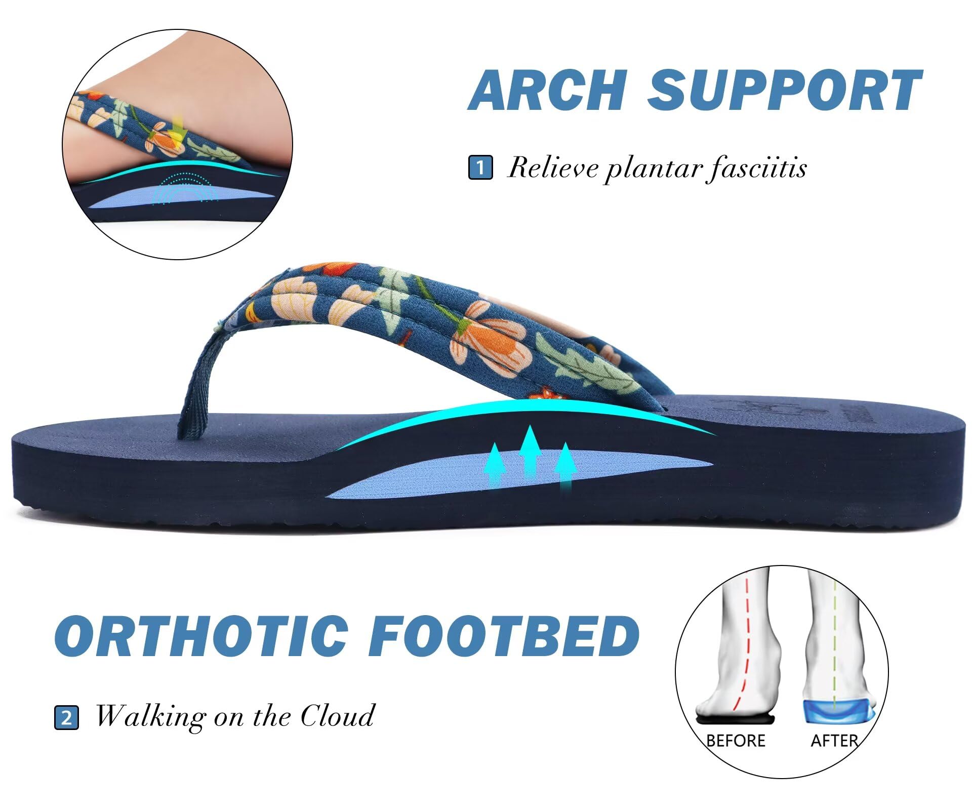 KuaiLu Infradito Donna Estive Comode Stoffa Righe Ciabatte Arch Support Spiaggia Piscina Sandali Mare Leggere Antiscivolo Gomma Suole