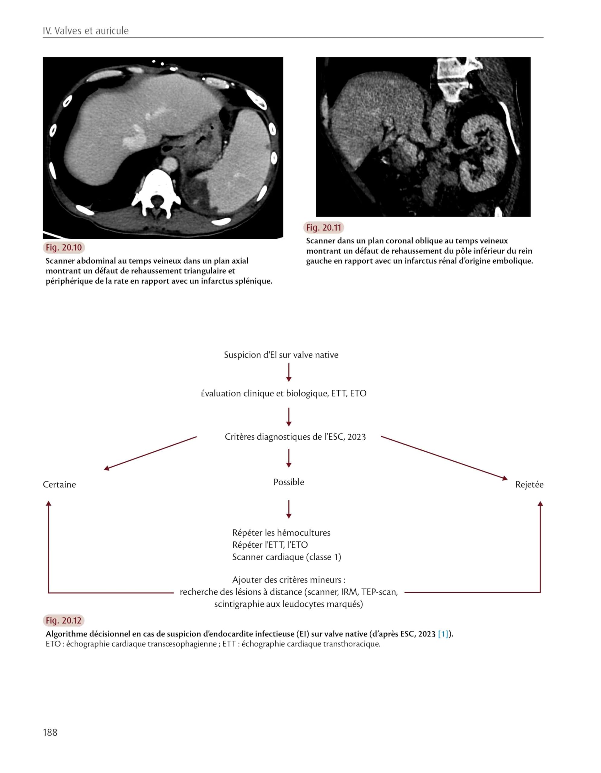 Radiologie cardiaque
