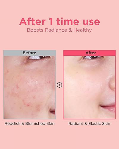 Miniatura 4 de EASYDEW DW-EGF Peptide Re-DERMA Master Ampolla – Suero facial coreano antienvejecimiento para el cuidado de la piel – Reafirmante, restaura la