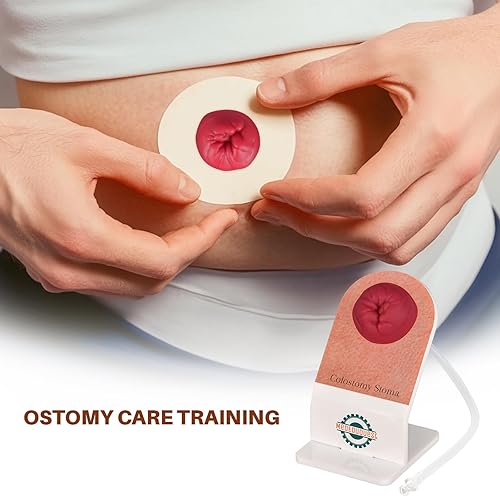 Miniatura 6 de Kit de entrenamiento para el cuidado de la ostomía, modelos de estoma para educación médica, kit de modelo de práctica de ostomía para demostración