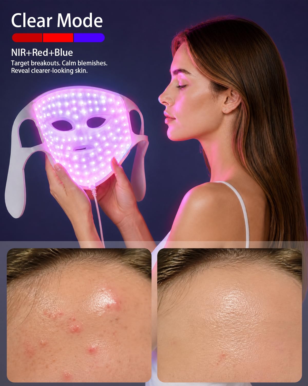 Maschera di terapia della luce rossa 3D per il viso, 5 lunghezze