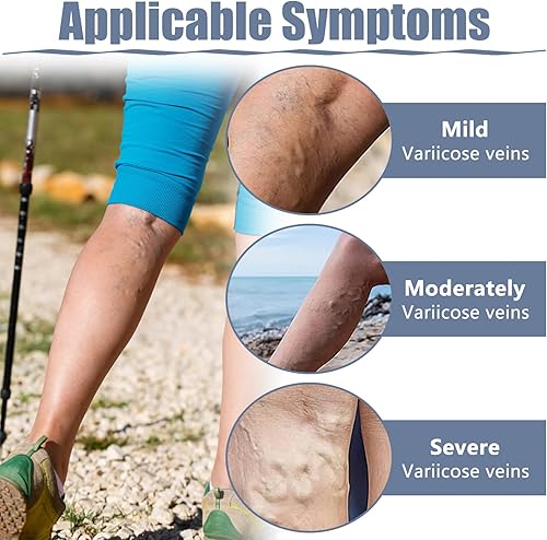 Miniatura 6 de 36 parches para venas varicosas, tratamiento natural de alivio para piernas, araña, varices, fortalece la salud capilar y mejora la circulación