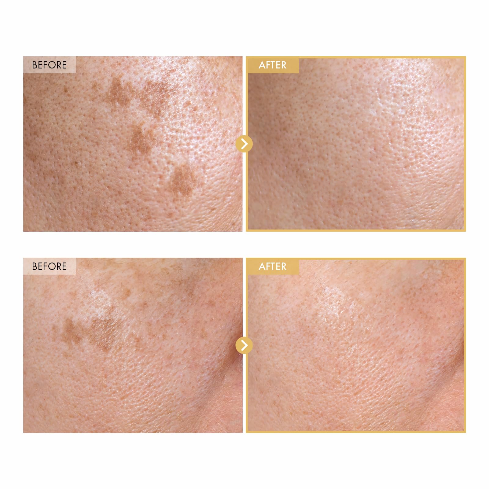 TOSOWOONG Black Snail Ginseng Serum, Ginseng 640,430ppm, Snail Mucin, Hydrating Facial Moisturizer, Self Care - Image 3