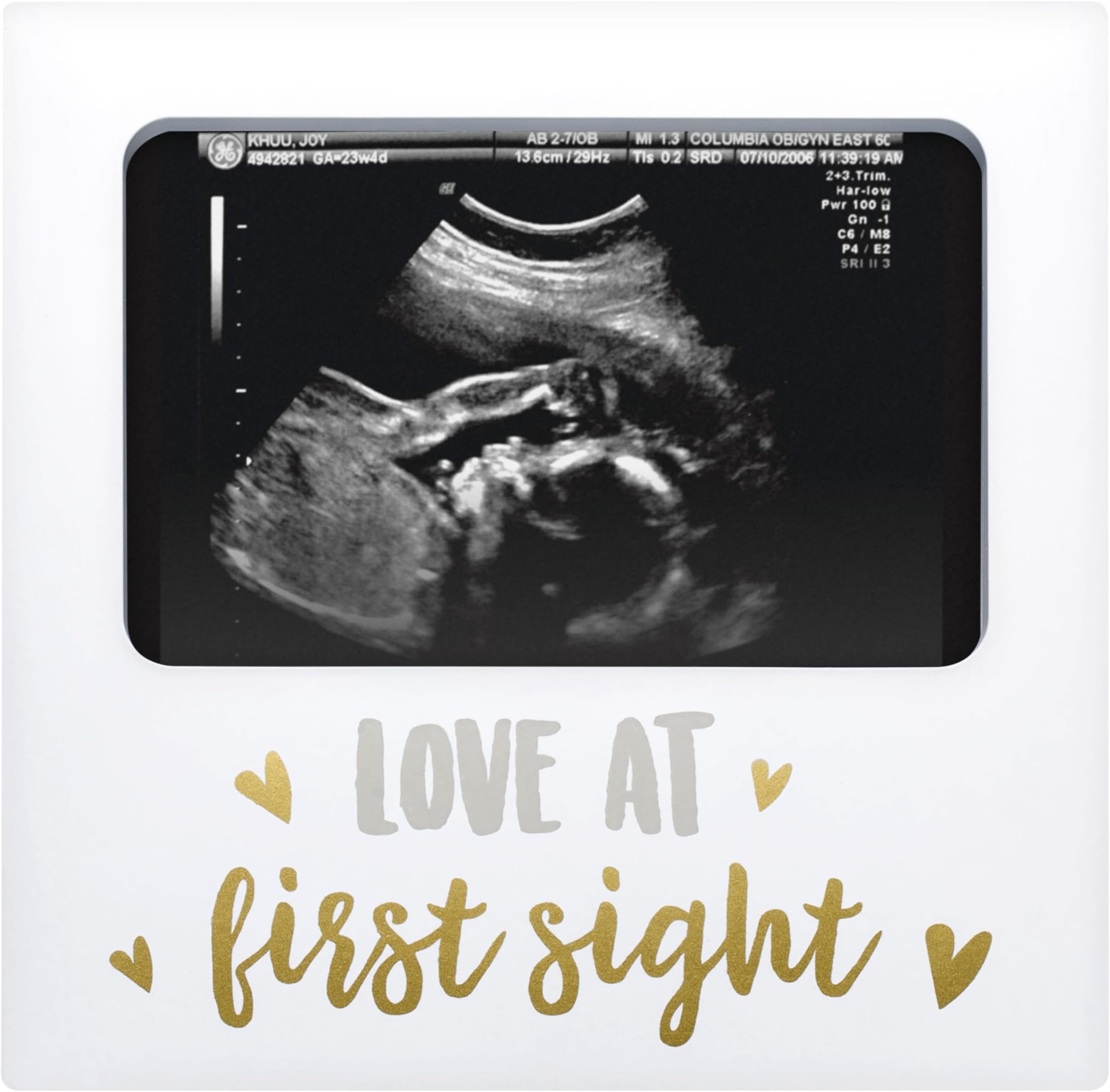 Tiny Ideas Love at First Sight Sonogram Picture Frame, Gender Neutral Ultrasound Keepsake, Ideal Pregnancy Gift, Baby Shower and Nursery Decor, 4” x6” Photo Insert, Gold, Silver And White