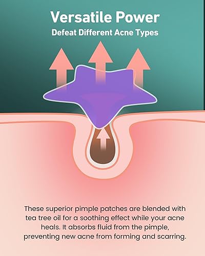 Miniatura 4 de Jefusst Parches de acné de estrellas con 112 puntos, parches de espinillas hidrocoloides para el rostro, parches de acné para la cara, lindos