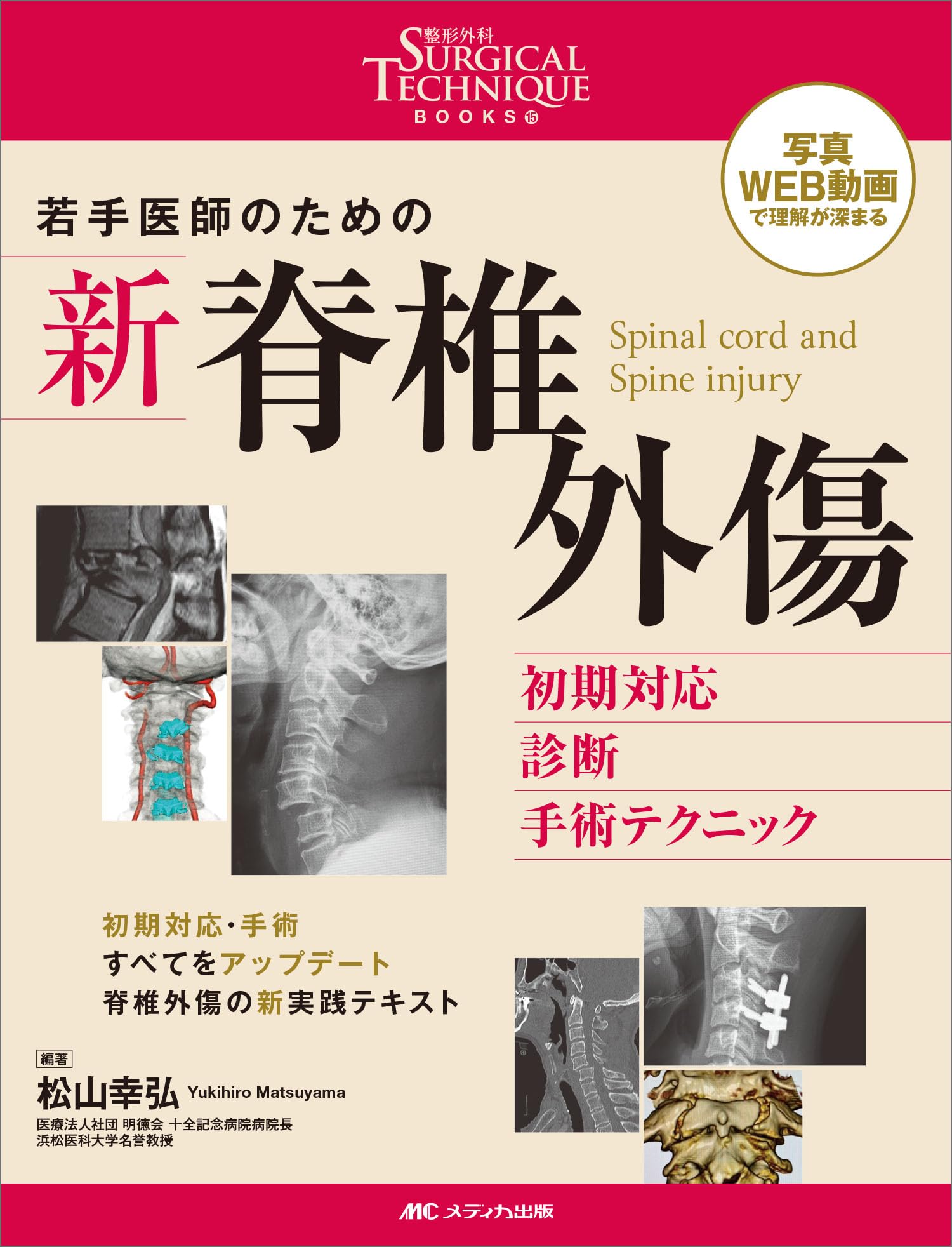 若手医師のための 新 脊椎外傷 : 初期対応・診断・手術テクニック 71slLtLUB2L.jpg