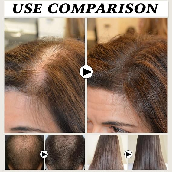 2PCS Deoxyribose Sugar Gel Hair Growth, Deoxy Ribose Sugar Hair Growth 60ml, Hair Growth Serum