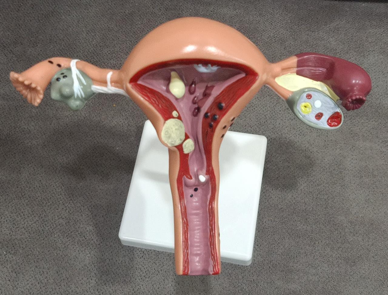 MAKE GOLD-Human Uterus Ovary Female Genital Organ, Reproductive Organ Model, Uterine Medical Teaching Anatomical Gynecology Uterus and Ovary Model