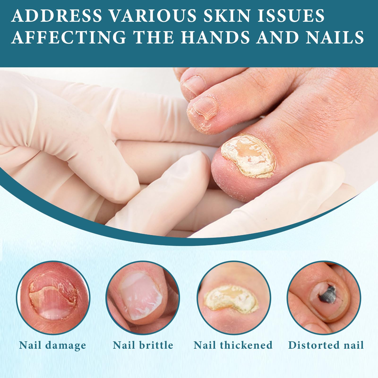 3 Pièce 3 Days Nail Care, Huile Cuticule Léger Pas Gras Absorption Rapide Ongles Forts et Brillants Réparation des Fissures Nourriture Profonde avec 1 Nail Care Pen