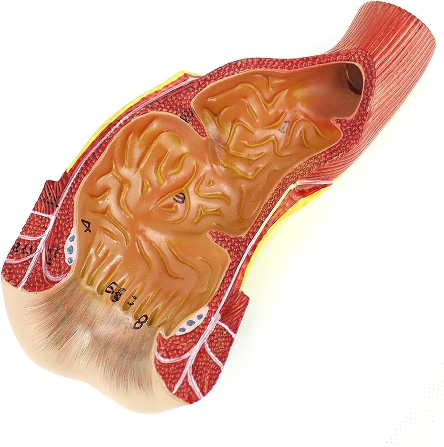 Modèle Anatomique du Rectum et de l'anus Humains, Anatomie Humaine Scientifique, Outils et Aides à la Formation des chirurgiens généraux en Chirurgie anorectale