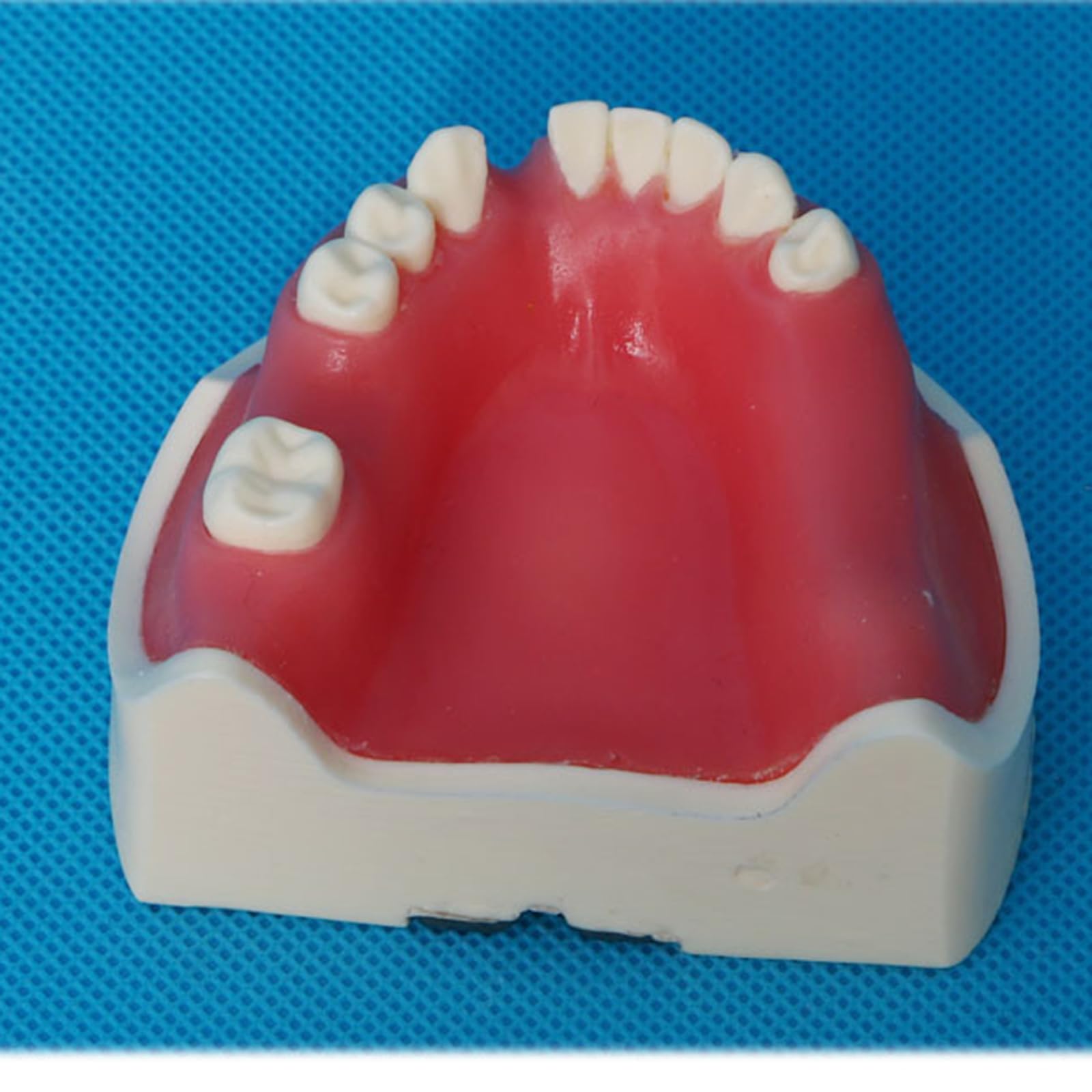 Modello di impianto Dentale - Modello di impianto mandibolare Medico e odontoiatrico - per Studio didattico Displaymedical Model,A5-8cm