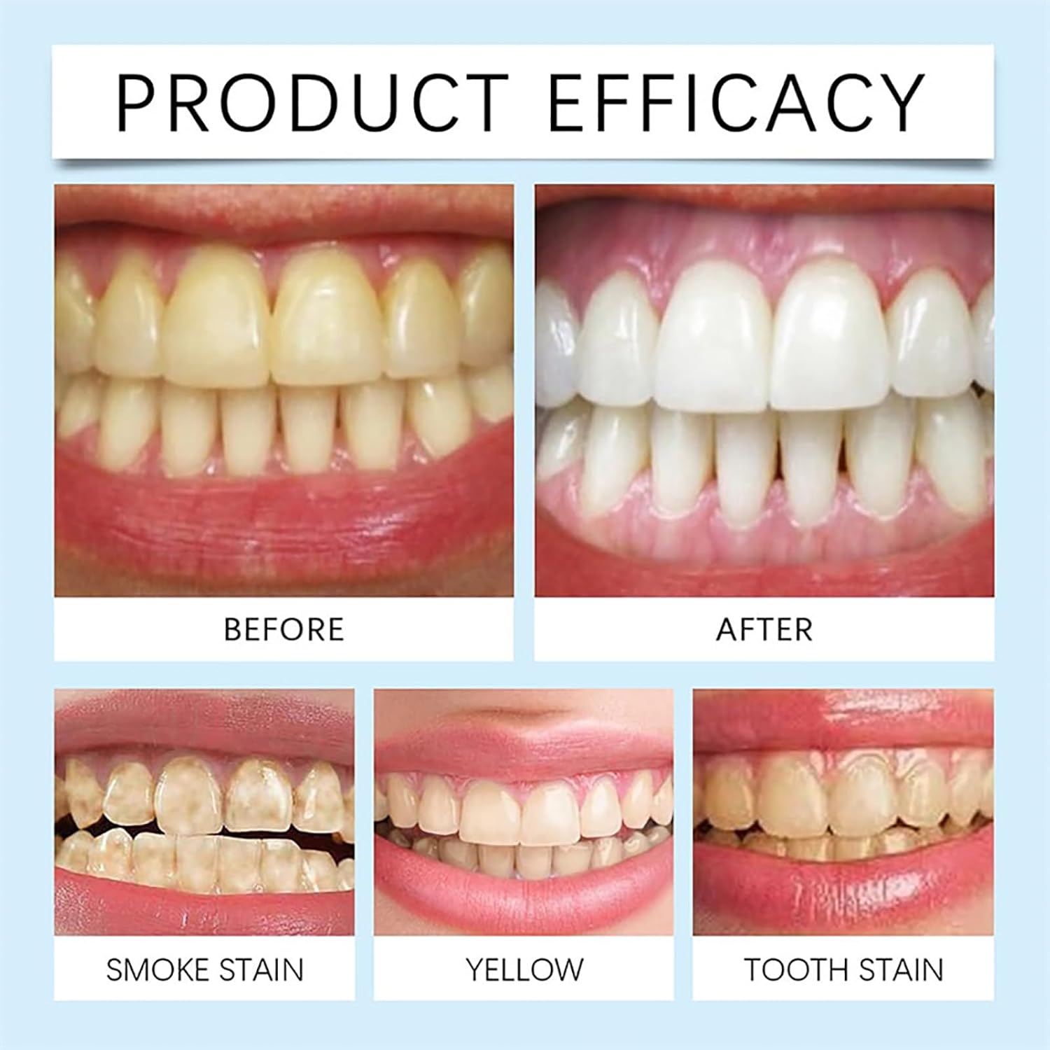 Tooth Repairing Powder, Hydroxyapatut Teeth Whitening Powder Toothpaste Power for Gum, Strengthens & Purifies & Stabilizes Teeth (*, 2PCS)