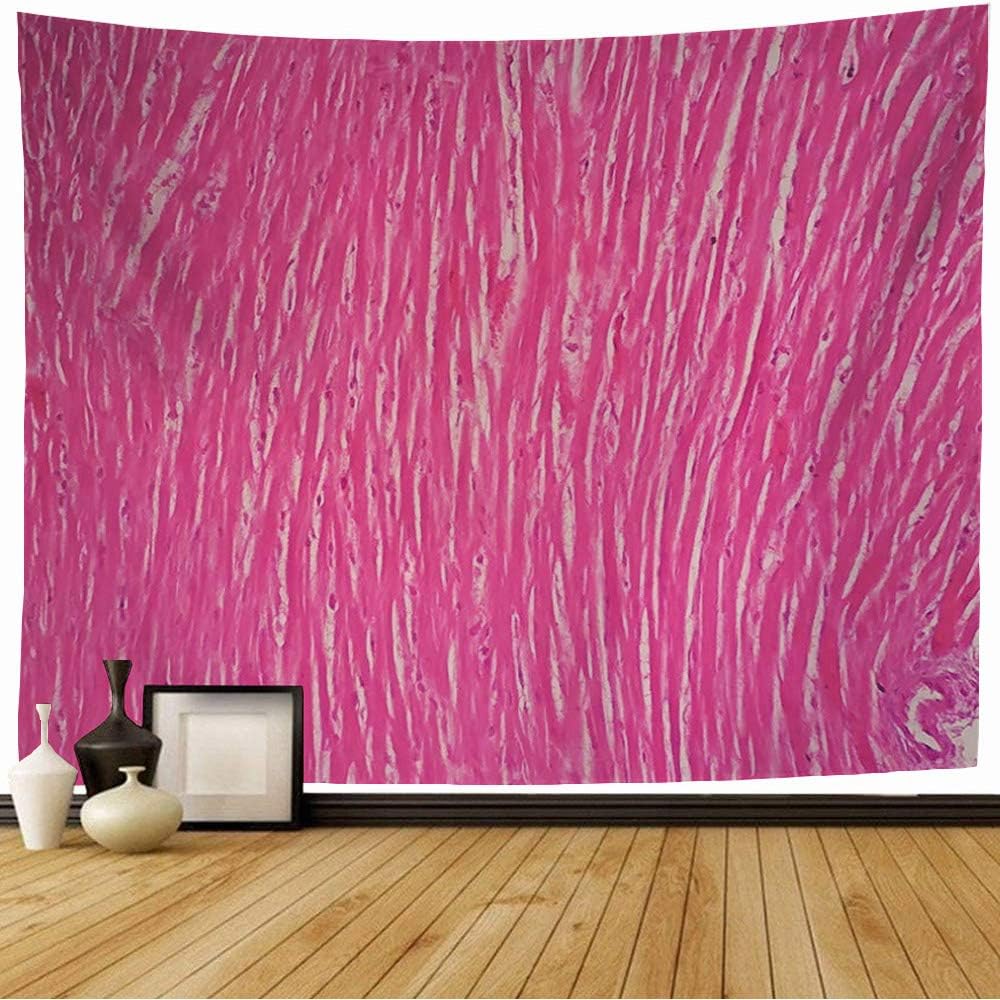 Starogs Tapestry Histology Disease Human Cardiac White