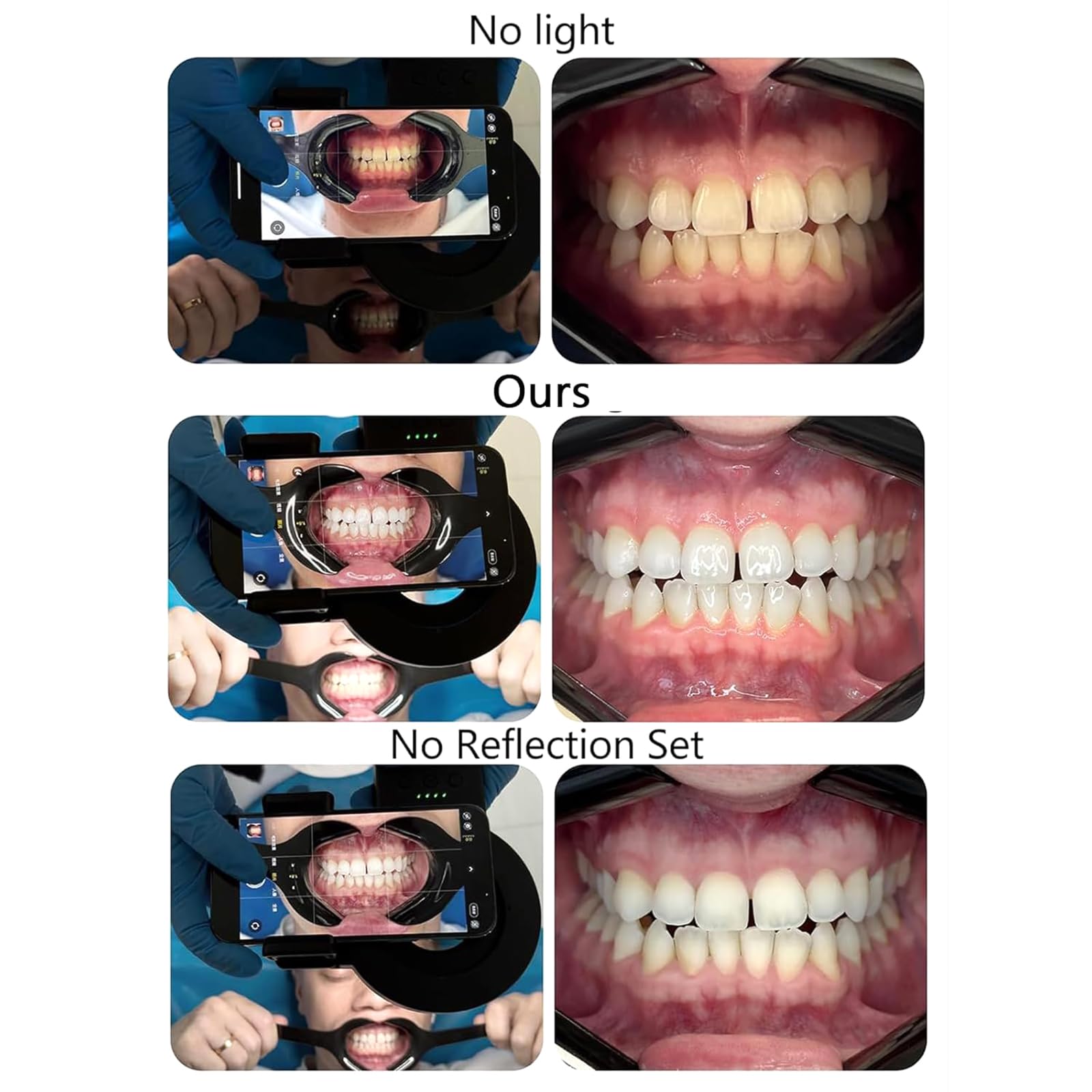 Luz LED De Relleno Bucal Para Odontología, Luz De Relleno Para Cámara De Teléfono Móvil Con Filtro De 49 Mm Y Lente Macro De 100 Mm, Temperatura De Color De 2500 K a 6000 K, Para Salón En Casa.