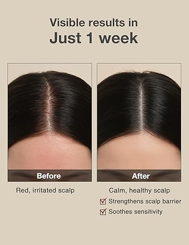 Miniatura 3 de TOUN28 Volumizing - Barra de champú de biotina vegana orgánica natural para el crecimiento del cabello y engrosamiento del carbón y soja negra para