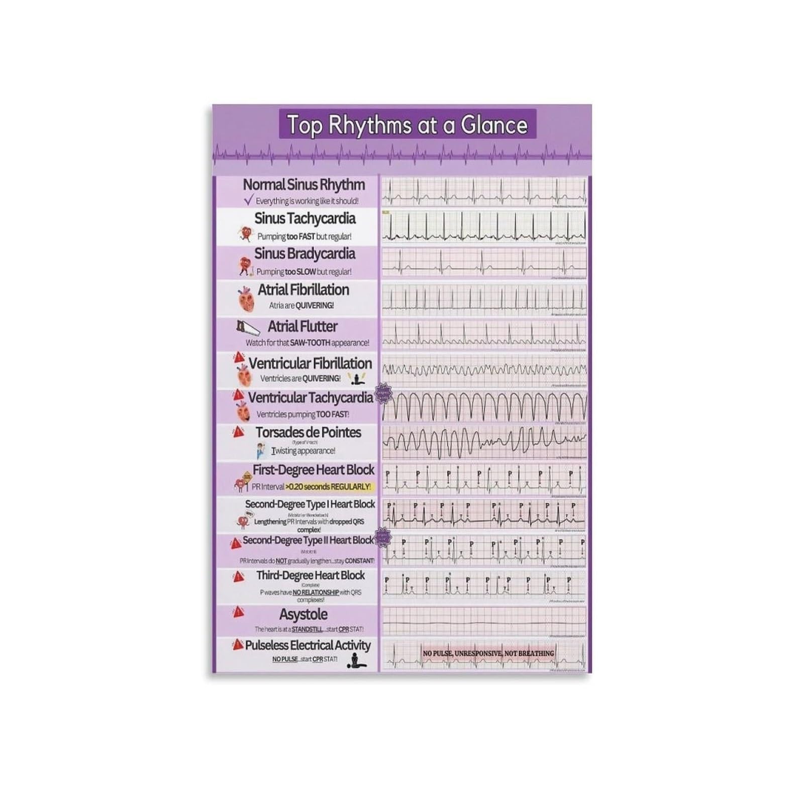 MQXFCZUX Cardiac Rhythm Educational Metal Chart EKG ECG Rhythms Reference for Nursing Student and Classroom Decor (8 X 12 in)