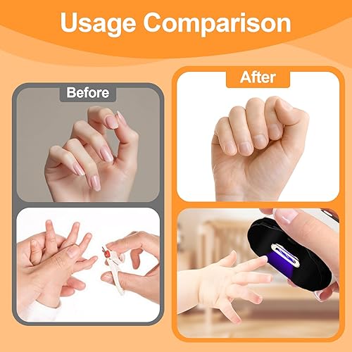 Miniatura 3 de Cortauñas eléctrico con 3 niveles de velocidad, recortador de uñas seguro y conveniente, recargable por USB para bebés, niños, adultos, personas