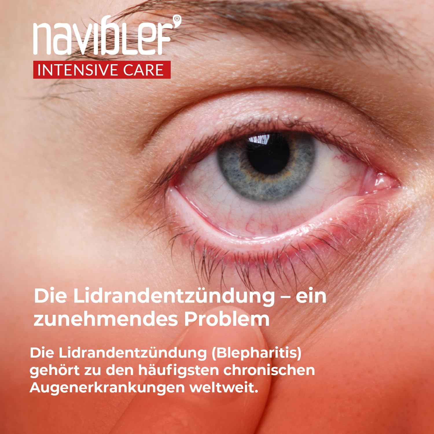 TTO Intensive Care Augenlidschaum – bei Blepharitis | 50 ml | mit Aloe Vera | intensive Hygiene für Augenlider und Wimpern | bei akuter Blepharitis und Demodex | Anwendung für 2 Wochen